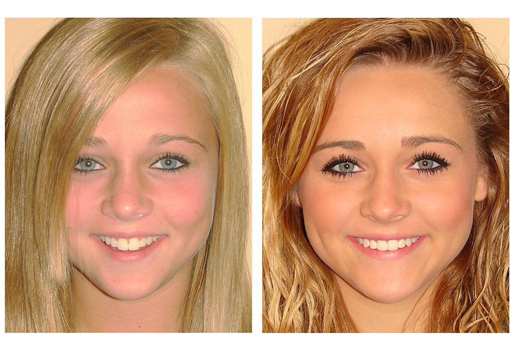 Diamond Dental Care, PLLC