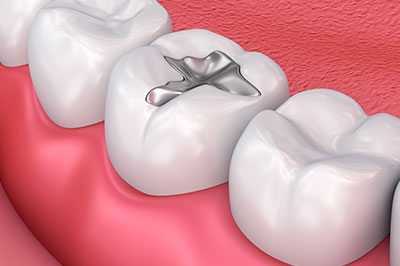 Diamond Dental Care, PLLC