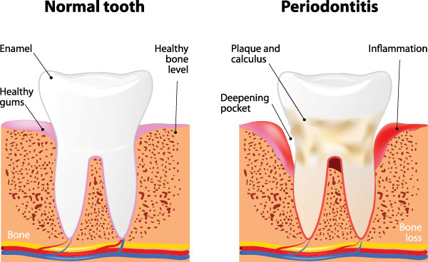 Diamond Dental Care, PLLC