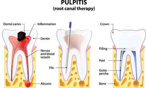 Diamond Dental Care, PLLC